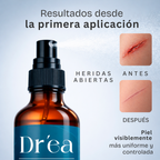 Spray dermolimpiador para piel expuesta, comprometida y con lesiones recurrentes