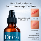 Spray dermolimpiador para piel expuesta, comprometida y con lesiones recurrentes