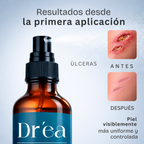Spray dermolimpiador para piel expuesta, comprometida y con lesiones recurrentes