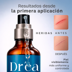 Gel dermolimpiador para piel expuesta, comprometida y con lesiones recurrentes