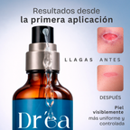 Gel dermolimpiador para piel expuesta, comprometida y con lesiones recurrentes